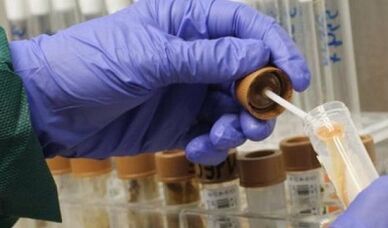 La necesidad de pasar el análisis de los parásitos