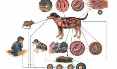 Causas y formas de infección con gusanos