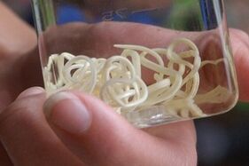 Parásitos del cuerpo humano.