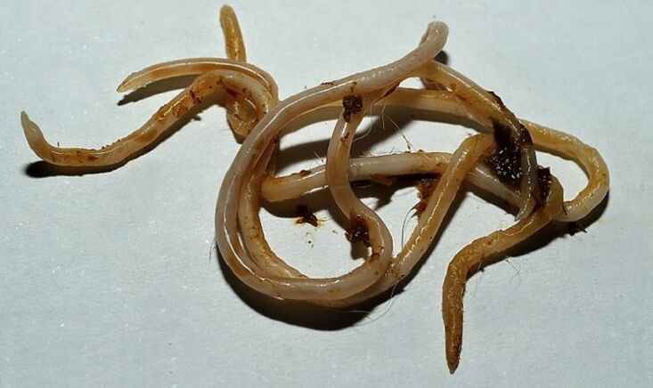 Toxocara del cuerpo humano